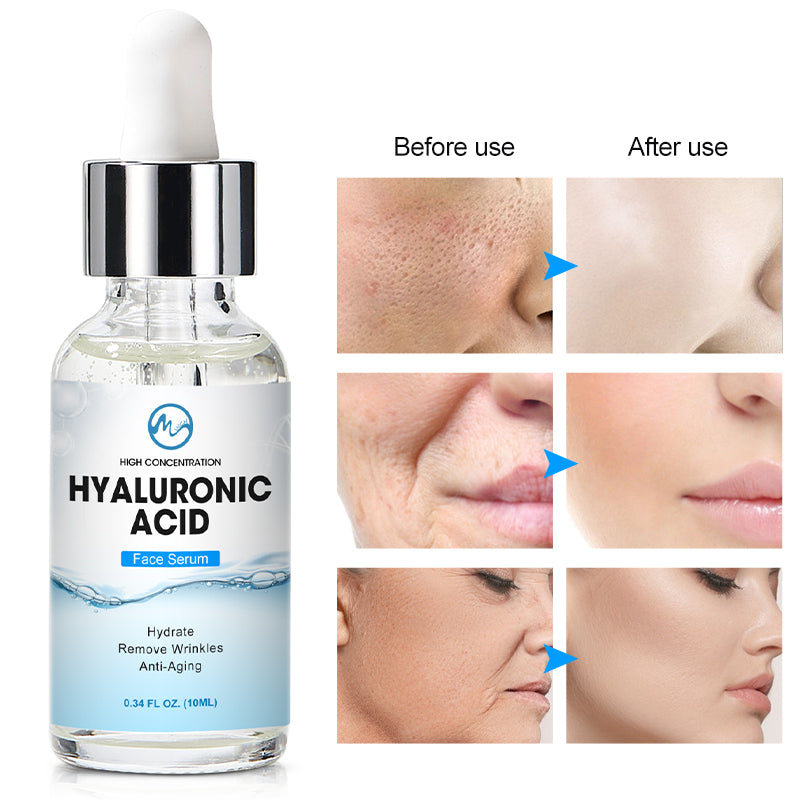 Compre 1 Leve 3 Serum Facial ácido hialurônico soro hidratante